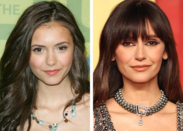 Nina Dobrev proudly advocates for aging naturally under the bright lights of the spotlight.