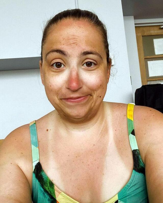 Sunglasses Left Marks After Poolside Weekend